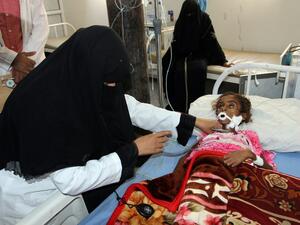 A doctor treats a malnourished Yemeni child at a hospital in the Yemeni port city of Hodeidah, on May 2, 2017. (AFP/Stringer)