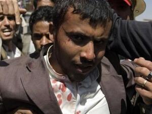 Yemeni wounded
