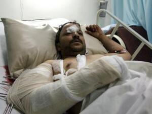 Yemen clashes