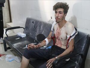 مقتل 10 مدنيين بينهم طفلان في قصف صاروخي للقوات الحكومية شمال غربي سوريا