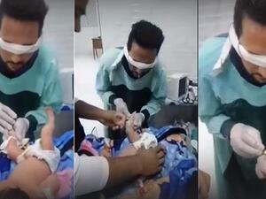 مصر.. طفل تحدي الكانيولا عانى آلاما تفوق البالغين بأربعة أضعاف