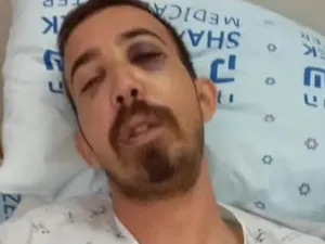 مستوطنون ينكلون بشاب يهودي بعدما ظنوه فلسطينيا