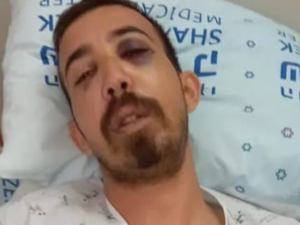 مستوطنون ينكلون بشاب يهودي بعدما ظنوه فلسطينيا