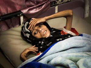 شبح المجاعة يلوح في أفق اليمن من جديد