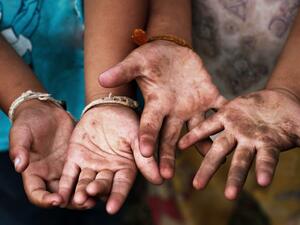 UN: COVID-19 Recession Puts Hundreds of Thousands of Children's Lives on Stake