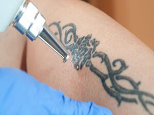 الوشم الحرام هو الذي يتم فيه خرز الإبر في الجلد ح