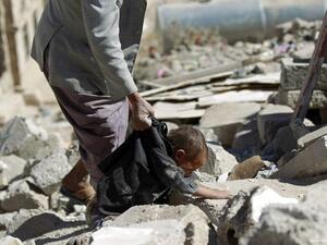 يشهد اليمن حرباً ضروساً بين القوات الموالية للحكومة التي يدعمها التحالف السعودي الإماراتي، ومسلحي مليشيا الحوثي