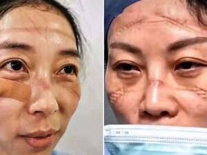 جروح الأطباء والممرضين خلال حربهم مع "الكورونا"