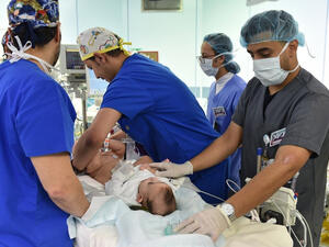 فصل التوأم الليبي أحمد ومحمد في مستشفى سعودي