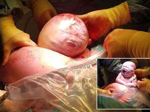 لحظة ولادة الطفل فينلي لحظة ولادة الطفل فينلي