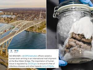 طرد يحوي دماغًا بشريًا