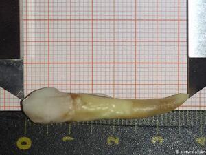 أطول سن بشري في التاريخ