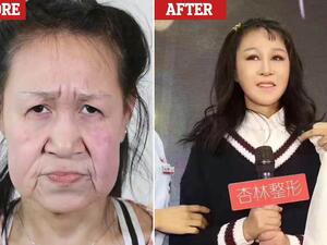 شياو فنغ (قبل/بعد)