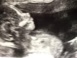 تعبيرية تعبيرية