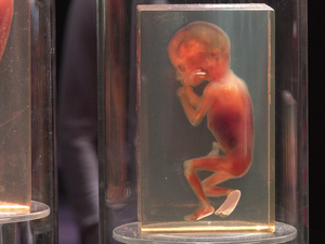 تعبيرية تعبيرية