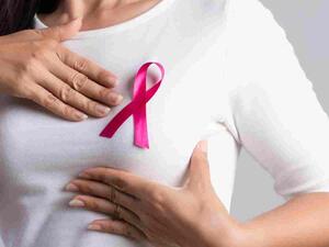 من أنواع السرطان التي تصيب الثدي سرطان الأقنية في الموقع 