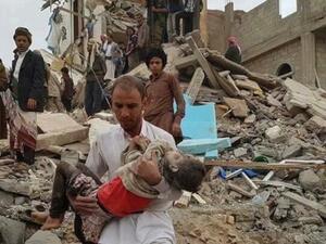  52 ألف يمني سقطوا بين قتيل وجريح جراء قصف التحالف العربي