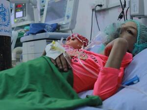 وفاة أكثر من 3 آلاف يمني بالكوليرا منذ 2016