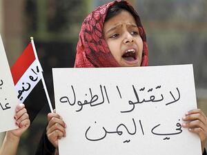  7550 طفلا على الأقل قتلوا أو أصيبوا جراء الحرب الأهلية في اليمن