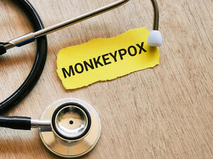 Man Diagnosed With First US Case of Monkeypox in 2022