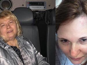 Human rights lawyer Marina Dubrovina in a police vehicle, and journalist Elena Milashina following separate attacks in Chechnya. Elena Milashina/Facebook