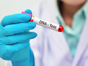 (Shutterstock/ File Photo)