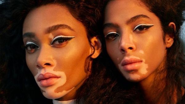 Winnie Harlow and Shahad Salman 