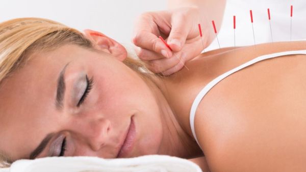 الوخز بالإبر يساعد في التخلص من آلام الظهر العنيدة