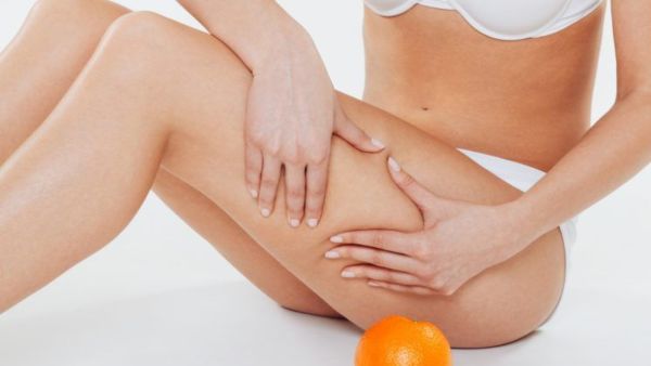 cellulite