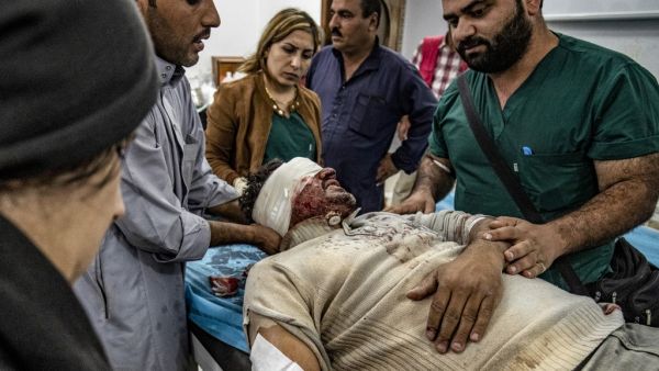 A Syrian Arab man injured by an explosion while entering the town of Ras Al-Ain, during the ceasefire amidst the ongoing Turkish offensive against Kurdish-controlled areas of northeastern Syria, receives medical treatment at a hospital in nearby Tal Tamr on October 22, 2019. (Delil SOULEIMAN / AFP)
