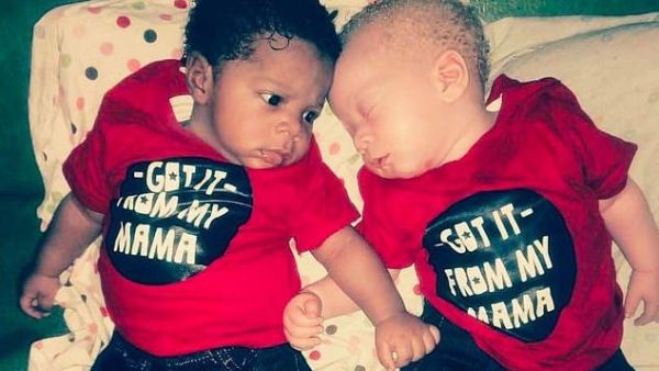 Daniel and his fair-skinned brother David were born on February 26 in Lagos, Nigeria (dailymail)