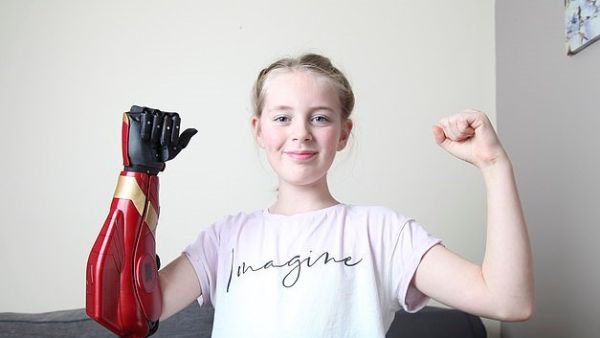 Hollie Lownds, 11, was left 'speechless' when she tried on her bionic arm (pictured) for the first time, paid for by an anonymous donor (dailymail)