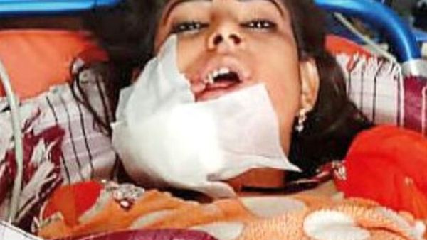 A 22-year-old dancer, identified only as Hina, was shot in the face during a wedding in India after she stopped for a break between songs. (Twitter)