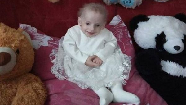 Eight-year-old Anna Sakidon (pictured aged six) died of old age in Ukraine after suffering from an exceptionally rare genetic progeria disease which only affects 160 people in the entire world. (Daily Mail)