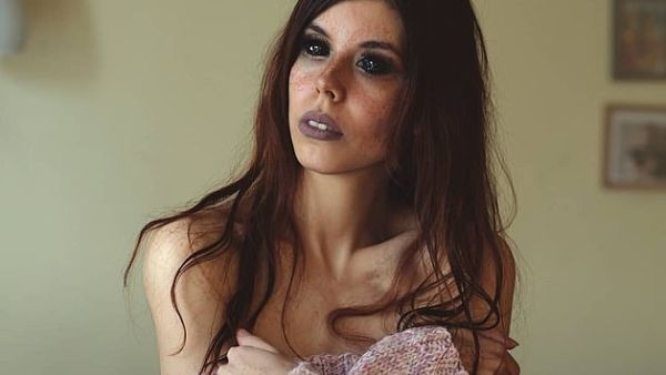 The brave model described herself as a food and animal lover on Instagram and vows not to let the loss of her sight bring her down (Instagram)