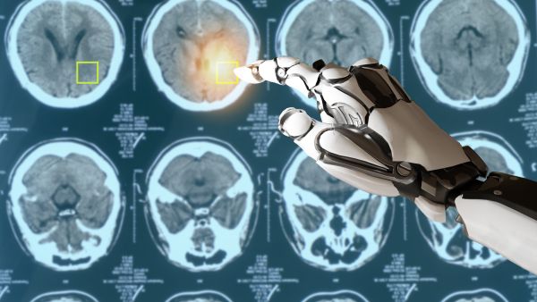 How Cutting Edge Technology is Revolutionizing Cancer Treatment as We Know It