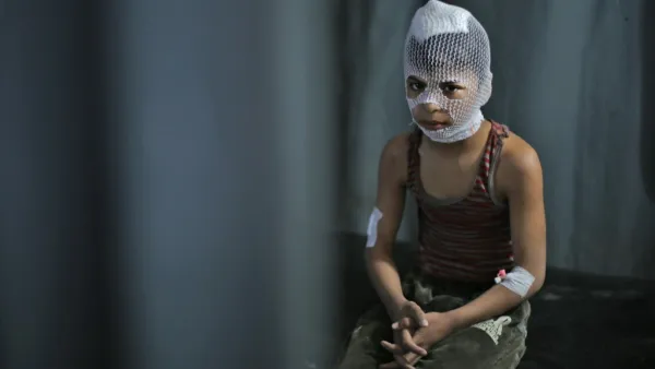 A wounded Syrian child sits at a makeshift clinic in the town of Maaret Misrin following Syrian government forces airstrikes on March 5, 2020 in the country's northwestern Idlib province. Russian air strikes killed at least 15 civilians including a child in the last major opposition bastion of Idlib in northwestern Syria, a Britain-based war monitor said.  Aref TAMMAWI / AFP