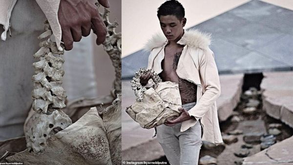 Arnold Pultra claims that his eerie product is 'ethically sourced' from medical surplus in Canada. (Instagram/Arnold Pultra)