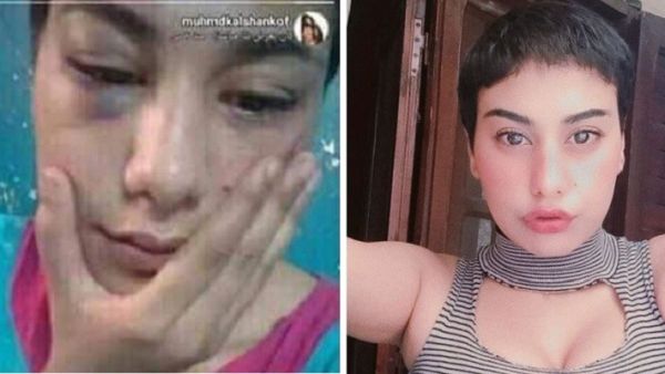 منة عبدالعزيز