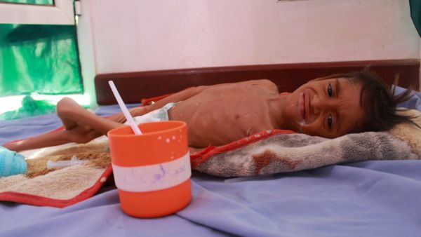 The long conflict has devastated the health system and displaced 3.3 million people who live in camps where cholera and other diseases are rife. ESSA AHMED / AFP