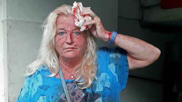 Valarie Fakhoury, a British-Lebanese national, stands outside the emergency ward of a hospital in the Hamra district of central Beirut following a huge explosion that rocked the Lebanese capital on August 4, 2020. A large explosion rocked the Lebanese capital Beirut on August 4, an AFP correspondent said. The blast, which rattled entire buildings and broke glass, was felt in several parts of the city. Janine HAIDAR / AFP