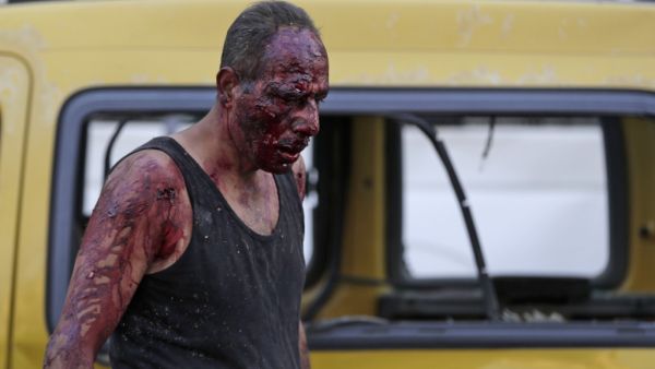 A wounded man walks at the port near the scene of an explosion in the Lebanese capital Beirut on August 4, 2020. Two huge explosion rocked the Lebanese capital Beirut, wounding dozens of people, shaking buildings and sending huge plumes of smoke billowing into the sky. Lebanese media carried images of people trapped under rubble, some bloodied, after the massive explosions, the cause of which was not immediately known.  ANWAR AMRO / AFP