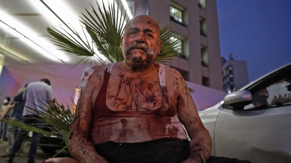 A wounded man receives help outside a hospital following an explosion in the Lebanese capital Beirut on August 4, 2020. Two huge explosion rocked the Lebanese capital Beirut, wounding dozens of people, shaking buildings and sending huge plumes of smoke billowing into the sky. Lebanese media carried images of people trapped under rubble, some bloodied, after the massive explosions, the cause of which was not immediately known.  IBRAHIM AMRO / AFP