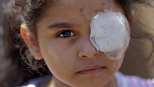 Sama al-Hamad, 6-year-old Syrian girl who lost her left eye in the August 4 cataclysmic explosion, poses for a picture on the roof of her damaged house in Beirut's Mar Mikhael district overlooking the blast site on August 16, 2020. ANWAR AMRO / AFP
