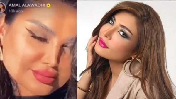 أمل العوضي تصدم الجميع بسبب عمليات التجميل المبالغ بها..فيديو!