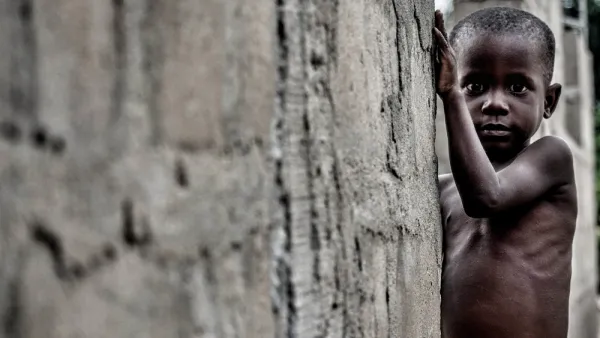 Nigerian boy suffering from malnutrition. (Shutterstock/ File Photo)