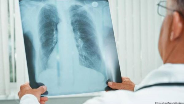 يساعد الحفاظ على رطوبة الجسم في التخلص من البلغم والمخاط السميك