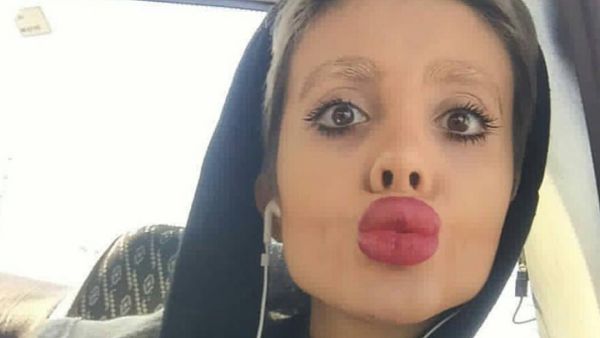 Iranian 'Zombie Angelina Jolie' (Instagram)