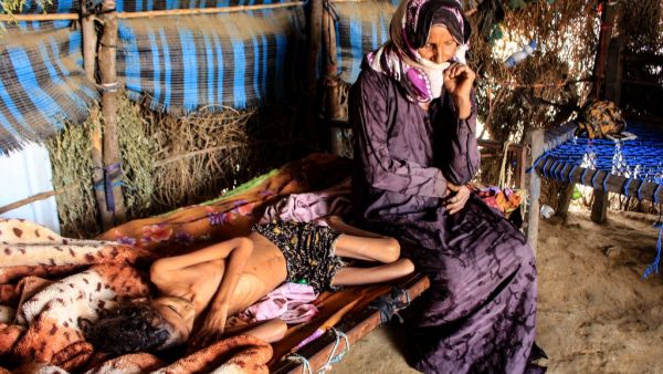 A Yemeni woman sits by the bedside of 10-year-old girl Ahmadia Abdo, who weighs ten kilograms due to acute malnutrition, at a camp for the internally displaced in the northern Hajjah Governorate, on January 23, 2021. About 400,000 children under the age of five are in danger of dying of acute malnutrition in war-torn and impoverished Yemen, UN agencies warned. ESSA AHMED / AFP