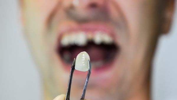 Man files a lawsuit after he slipped and broke his teeth